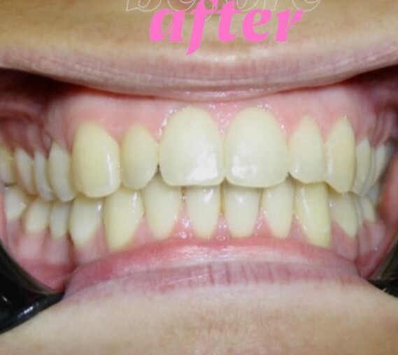 After