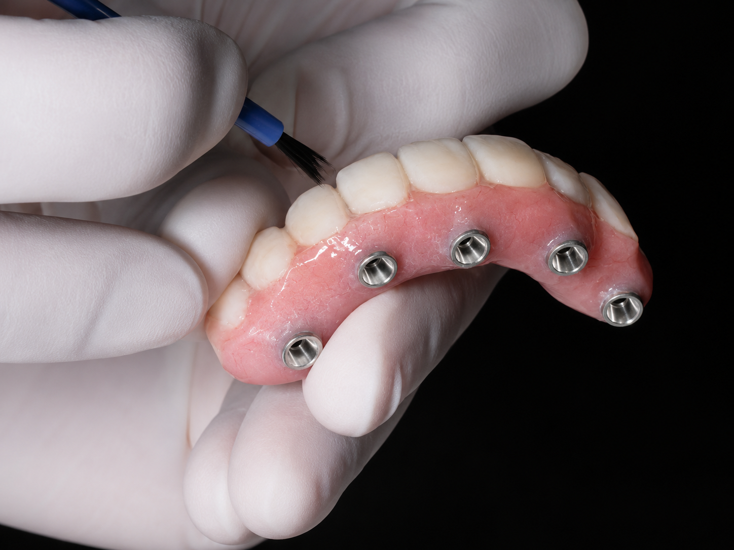 Bone graft and implant planning illustration