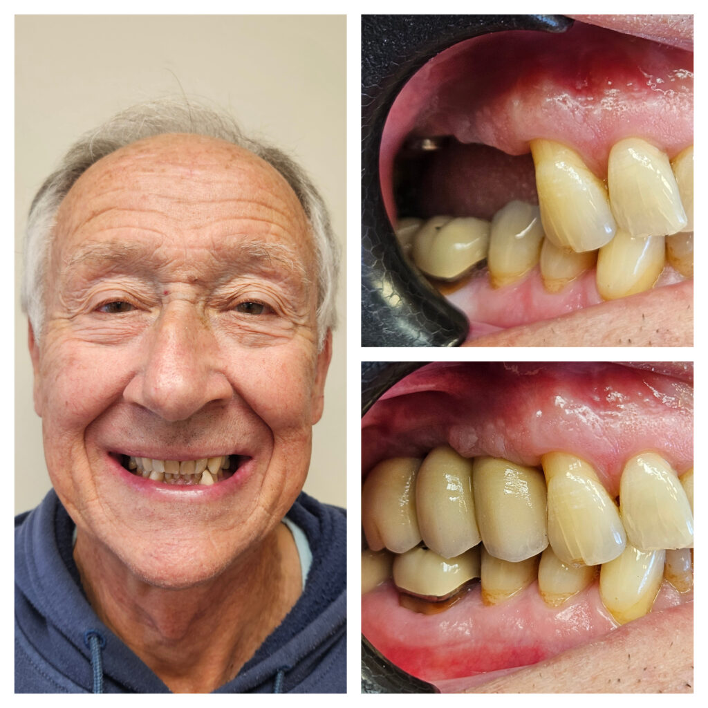 Case 3 — smile and intra-oral views