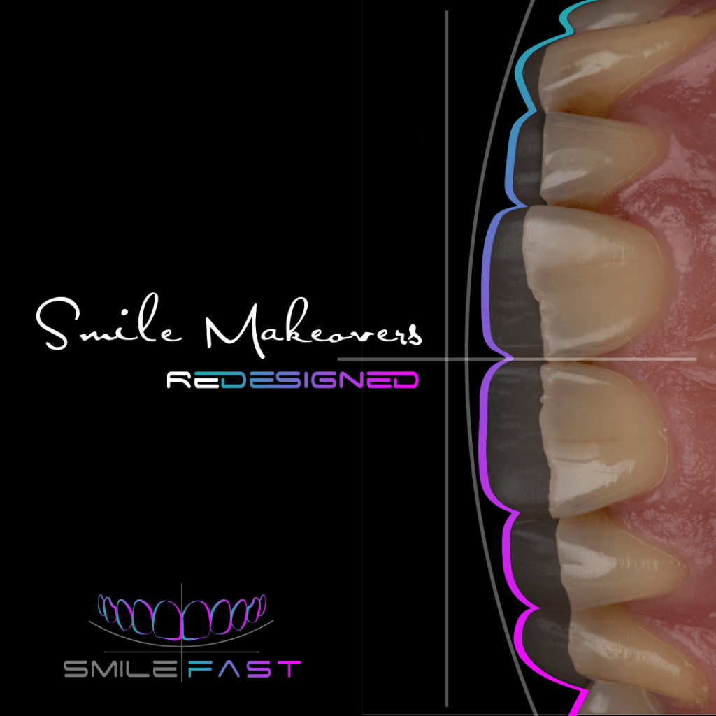 SmileFast — Smile Makeovers Redesigned