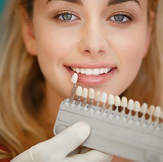 Porcelain veneers at Woodbridge Hill Dental Practice, Guildford
