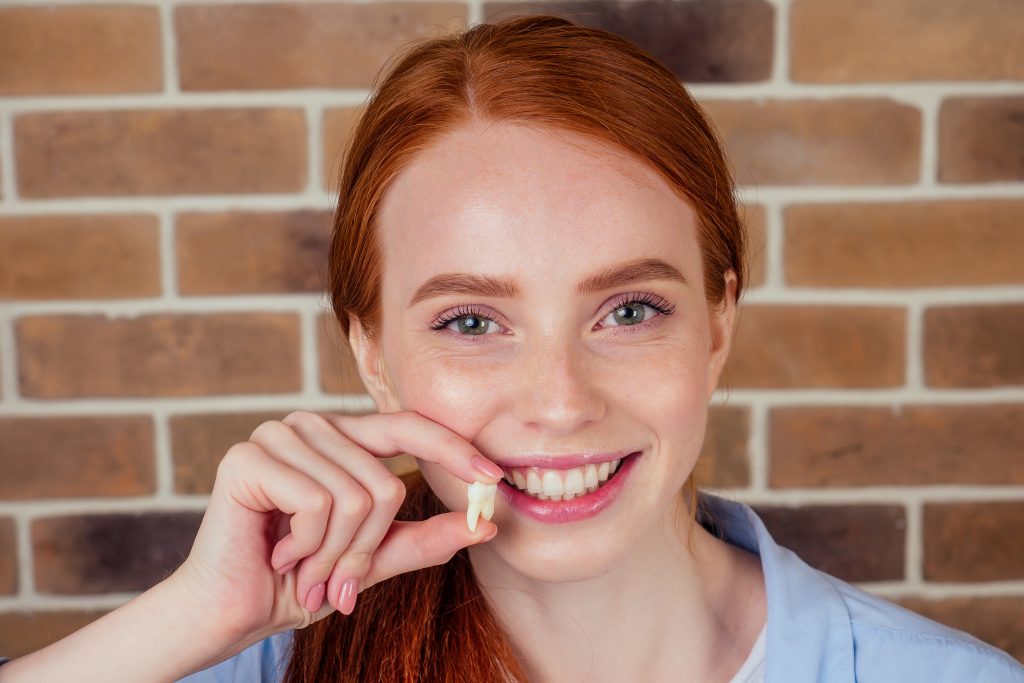 Patient after a wisdom tooth extraction in Guildford